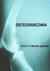 book Osteosarcoma