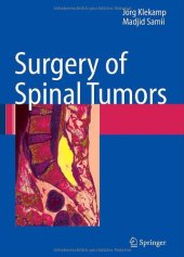 book Surgery of Spinal Tumors