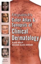 book Fitzpatrick Color Atlas and Synopsis of Clinical Dermatology (Fitzpatrick's Color Atlas & Synopsis of Clinical Dermatology)