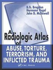 book A radiologic atlas of abuse, torture, terrorism, and inflicted trauma