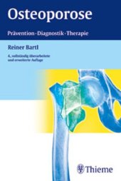 book Osteoporose : Prävention, Diagnostik, Therapie