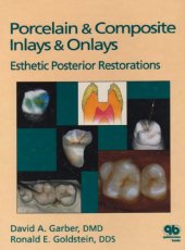 book Porcelain & Composite Inlays & Onlays: Esthetic Posterior Restorations