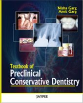 book Textbook of Preclinical Conservative Dentistry