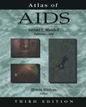 book Atlas of AIDS