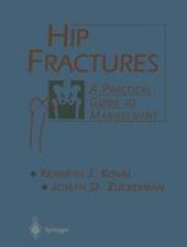 book Hip Fractures: A Practical Guide to Management