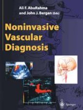 book Noninvasive Vascular Diagnosis