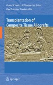 book Transplantation of Composite Tissue Allografts