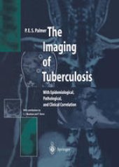 book The Imaging of Tuberculosis: With Epidemiological, Pathological, and Clinical Correlation