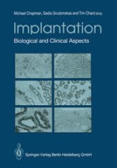 book Implantation: Biological and Clinical Aspects