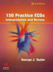 book 150 Practice ECGs: Interpretation and Review, Third Edition