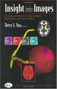 cover of the book Insight into images: principles and practice for segmentation, registration, and image analysis