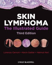 cover of the book Skin Lymphoma: The Illustrated Guide, Third Edition