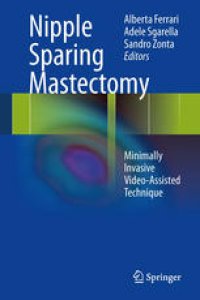 cover of the book Nipple Sparing Mastectomy: Minimally Invasive Video-Assisted Technique