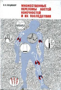 cover of the book Множественные переломы костей конечностей и их последствия