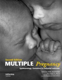 cover of the book Multiple pregnancy