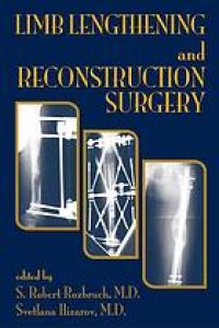 cover of the book Limb lengthening and reconstructive surgery