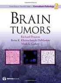 cover of the book Brain tumors