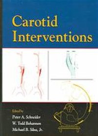 cover of the book Carotid interventions