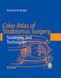 cover of the book Color Atlas of Strabismus Surgery: Strategies and Techniques