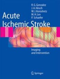 cover of the book Acute Ischemic Stroke: Imaging and Intervention