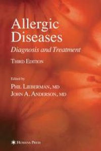 cover of the book Allergic Diseases: Diagnosis and Treatment