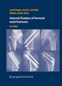 cover of the book Internal fixation of femoral neck fractures: An atlas