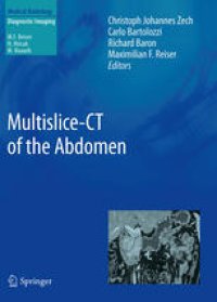 cover of the book Multislice-CT of the Abdomen