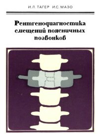 cover of the book Рентгенодиагностика смещений поясничных позвонков.