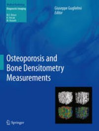 cover of the book Osteoporosis and Bone Densitometry Measurements