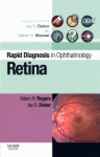 cover of the book Retina