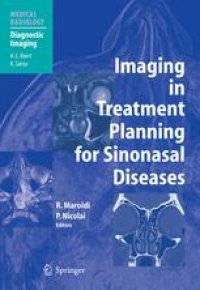 cover of the book Imaging in Treatment Planning for Sinonasal Diseases