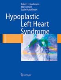 cover of the book Hypoplastic Left Heart Syndrome