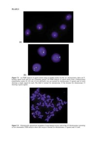 cover of the book Preimplantation Genetic Diagnosis