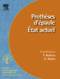 cover of the book Prothèses d'épaule. État actuel