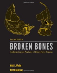 cover of the book Broken Bones: Anthropological Analysis of Blunt Force Trauma