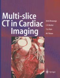 cover of the book Multi-slice CT in Cardiac Imaging: Technical Principles, Clinical Application and Future Developments