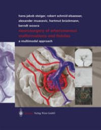 cover of the book Neurosurgery of Arteriovenous Malformations and Fistulas: A Multimodal Approach