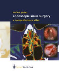 cover of the book Endoscopic Sinus Surgery: A Comprehensive Atlas