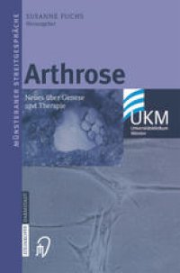 cover of the book Arthrose: Neues über Genese und Therapie