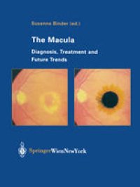 cover of the book The Macula: Diagnosis, Treatment and Future Trends