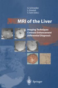 cover of the book MRI of the Liver: Imaging Techniques Contrast Enhancement Differential Diagnosis