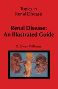 cover of the book Renal Disease: An Illustrated Guide