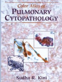 cover of the book Color Atlas of Pulmonary Cytopathology