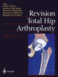 cover of the book Revision Total Hip Arthroplasty