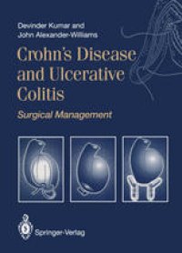 cover of the book Crohn’s Disease and Ulcerative Colitis: Surgical Management