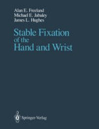 cover of the book Stable Fixation of the Hand and Wrist