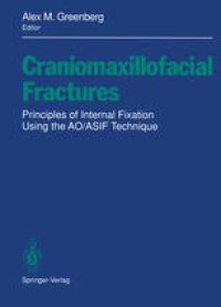 cover of the book Craniomaxillofacial Fractures: Principles of Internal Fixation Using the AO/ASIF Technique