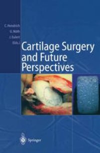 cover of the book Cartilage Surgery and Future Perspectives