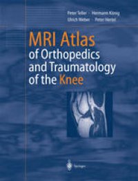 cover of the book MRI Atlas of Orthopedics and Traumatology of the Knee