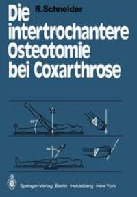 cover of the book Die intertrochantere Osteotomie bei Coxarthrose